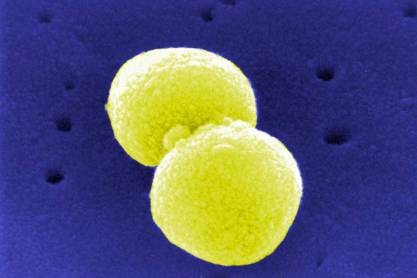 Pneumokokken